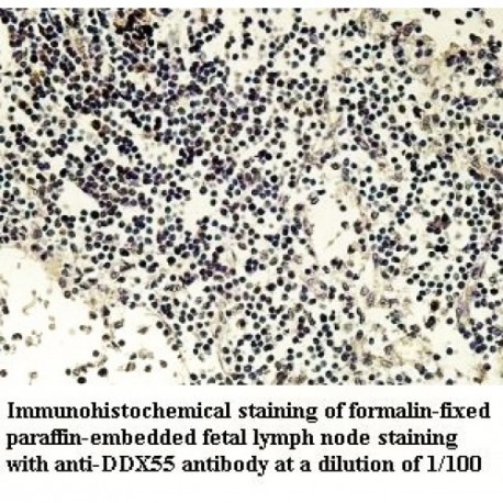 DDX55 Antibody