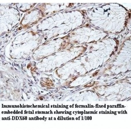 DDX60 Antibody