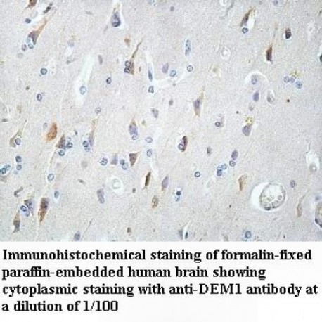 DEM1 Antibody