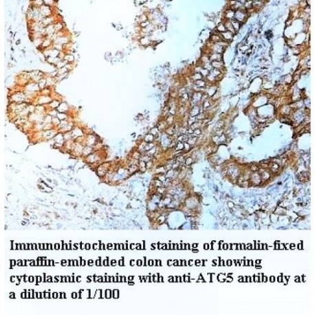 ATG5 Antibody