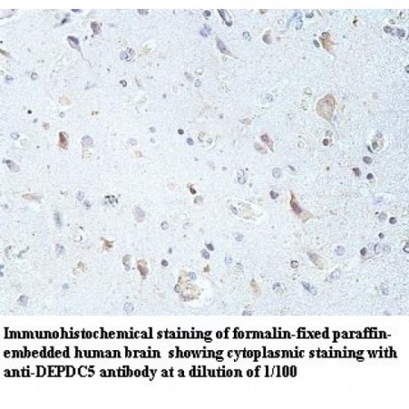 DEPDC5 Antibody