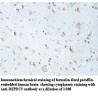 DEPDC5 Antibody