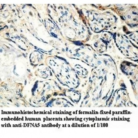 DFNA5 Antibody