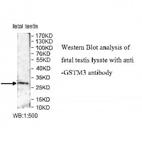 GSTM3 Antibody