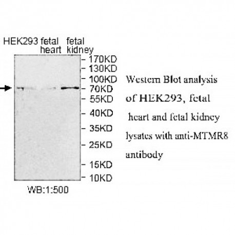 MTMR8 Antibody