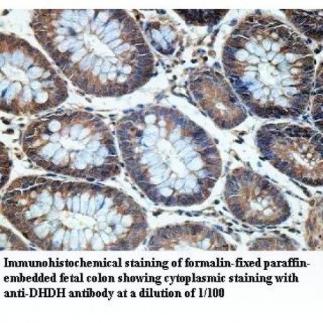 DHDH Antibody