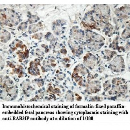 RAB3IP Antibody