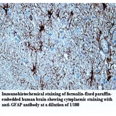 GFAP Antibody