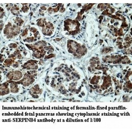 SERPINB4 Antibody