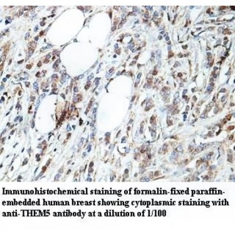 THEM5 Antibody