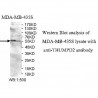 THUMPD2 Antibody