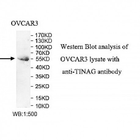 TINAG Antibody