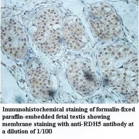 RDH5 Antibody