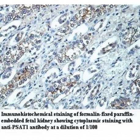 PSAT1 Antibody