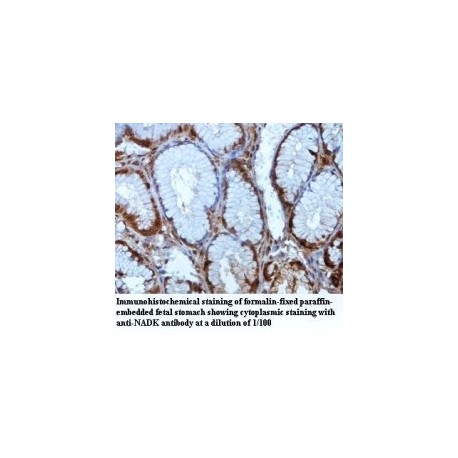 NADK Antibody
